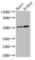 Western Blot; Positive WB detected in: Mouse heart tissue, Mouse kidney tissue; All lanes: SIGLEC7 antibody at 3µg/ml; Secondary; Goat polyclonal to rabbit IgG at 1/50000 dilution; Predicted band size: 52, 42, 17 kDa; Observed band size: 52 kDa;