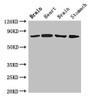 Western Blot; Positive WB detected in: Rat brain tissue, Rat heart tissue, Mouse brain tissue, Mouse stomach tissue; All lanes: SLCO1B1 antibody at 4µg/ml; Secondary; Goat polyclonal to rabbit IgG at 1/50000 dilution; Predicted band size: 77 kDa; Observed band size: 77 kDa;