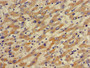 Immunohistochemistry of paraffin-embedded human liver cancer using CAC07959 at dilution of 1:100