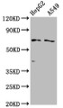 Western Blot; , Positive WB detected in: HepG2 whole cell lysate, A549 whole cell lysate; , All lanes: SLCO1B1 antibody at 1:2000; , Secondary; , Goat polyclonal to rabbit IgG at 1/50000 dilution; , Predicted band size: 77 kDa; , Observed band size: 77 kDa;