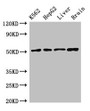 Western Blot; Positive WB detected in: K562 whole cell lysate, HepG2 whole cell lysate, Rat liver tissue, Mouse brain tissue; All lanes: RUVBL2 antibody at 2.4µg/ml; Secondary; Goat polyclonal to rabbit IgG at 1/50000 dilution; Predicted band size: 52, 47 kDa; Observed band size: 52 kDa;