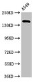 Western Blot; Positive WB detected in: A549 whole cell lysate; All lanes: A2ML1 antibody at 3.2µg/ml; Secondary; Goat polyclonal to rabbit IgG at 1/50000 dilution; Predicted band size: 162, 106 kDa; Observed band size: 162 kDa