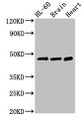 Western Blot; Positive WB detected in: HL60 whole cell lysate, Mouse brain tissue, Rat heart tissue; All lanes: CHST1 antibody at 3µg/ml; Secondary; Goat polyclonal to rabbit IgG at 1/50000 dilution; Predicted band size: 47 kDa; Observed band size: 47 kDa