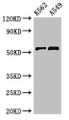 Western Blot; Positive WB detected in: K562 whole cell lysate, A549 whole cell lysate; All lanes: CELF2 antibody at 3µg/ml; Secondary; Goat polyclonal to rabbit IgG at 1/50000 dilution; Predicted band size: 55, 53, 56 kDa; Observed band size: 55 kDa