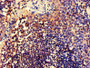 IHC image diluted at 1:600 and staining in paraffin-embedded human tonsil tissue performed on a Leica BondTM system. After dewaxing and hydration, antigen retrieval was mediated by high pressure in a citrate buffer (pH 6.0). Section was blocked with 10% normal goat serum 30min at RT. Then primary antibody (1% BSA) was incubated at 4°C overnight. The primary is detected by a biotinylated secondary antibody and visualized using an HRP conjugated SP system.