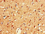 IHC image diluted at 1:600 and staining in paraffin-embedded human brain tissue performed on a Leica BondTM system. After dewaxing and hydration, antigen retrieval was mediated by high pressure in a citrate buffer (pH 6.0). Section was blocked with 10% normal goat serum 30min at RT. Then primary antibody (1% BSA) was incubated at 4°C overnight. The primary is detected by a biotinylated secondary antibody and visualized using an HRP conjugated SP system.