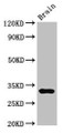 Western Blot; Positive WB detected in: Mouse brain tissue; All lanes: DNASE1 antibody at 3µg/ml; Secondary; Goat polyclonal to rabbit IgG at 1/50000 dilution; Predicted band size: 32, 20 kDa; Observed band size: 32 kDa;