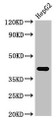 Western Blot; Positive WB detected in: HepG2 whole cell lysate; All lanes: FDPS antibody at 3µg/ml; Secondary; Goat polyclonal to rabbit IgG at 1/50000 dilution; Predicted band size: 49, 41 kDa; Observed band size: 41 kDa