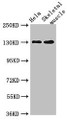 Western Blot; Positive WB detected in: Hela whole cell lysate, Mouse skeletal muscle tissue; All lanes: PER3 antibody at 4µg/ml; Secondary; Goat polyclonal to rabbit IgG at 1/50000 dilution; Predicted band size: 132, 133 kDa; Observed band size: 132 kDa