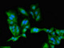 Immunofluorescent analysis of Hela cells using CAC08017 at dilution of 1:100 and Alexa Fluor 488-congugated AffiniPure Goat Anti-Rabbit IgG(H+L)