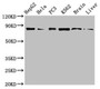 Western Blot; Positive WB detected in: HepG2 whole cell lysate, Hela whole cell lysate, PC-3 whole cell lysate, K562 whole cell lyaste, Mouse brain tissue, Rat liver tissue; All lanes: STAT4 antibody at 1µg/ml; Secondary; Goat polyclonal to rabbit IgG at 1/50000 dilution; Predicted band size: 86 kDa; Observed band size: 86 kDa
