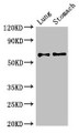 Western Blot; Positive WB detected in: Mouse lung tissue, Mouse stomach tissue; All lanes: GAD2 antibody at 2.7µg/ml; Secondary; Goat polyclonal to rabbit IgG at 1/50000 dilution; Predicted band size: 66 kDa; Observed band size: 66 kDa;