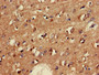 Immunohistochemistry of paraffin-embedded human brain tissue using CAC08038 at dilution of 1:100