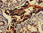 Immunohistochemistry of paraffin-embedded human lung tissue using CAC08038 at dilution of 1:100