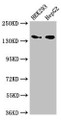 Western Blot; Positive WB detected in: HEK293 whole cell lysate, HepG2 whole cell lysate; All lanes: MAN2A1 antibody at 3.5µg/ml; Secondary; Goat polyclonal to rabbit IgG at 1/50000 dilution; Predicted band size: 132 kDa; Observed band size: 150 kDa;