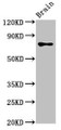 Western Blot; Positive WB detected in: Rat brain tissue; All lanes: CASC1 antibody at 3.4µg/ml; Secondary; Goat polyclonal to rabbit IgG at 1/50000 dilution; Predicted band size: 84, 79, 82, 76 kDa; Observed band size: 84 kDa;