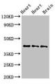 Western Blot; Positive WB detected in: Rat heart tissue, Mouse heart tissue, Mouse brain tissue; All lanes: NPSR1 antibody at 4µg/ml; Secondary; Goat polyclonal to rabbit IgG at 1/50000 dilution; Predicted band size: 43, 36, 45, 44, 42, 19, 16, 17, 11 kDa; Observed band size: 43 kDa;