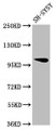 Western Blot; , Positive WB detected in: SH-SY5Y whole cell lysate; , All lanes: VPS39 antibody at 1:2000; , Secondary; , Goat polyclonal to rabbit IgG at 1/50000 dilution; , Predicted band size: 102, 101 kDa; , Observed band size: 102 kDa;