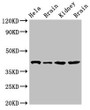 Western Blot; Positive WB detected in: Hela whole cell lysate, Rat brain tissue, Mouse kidney tissue, Mouse brain tissue; All lanes: ATAD1 antibody at 4µg/ml; Secondary; Goat polyclonal to rabbit IgG at 1/50000 dilution; Predicted band size: 41, 33 kDa; Observed band size: 41 kDa;