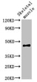 Western Blot; Positive WB detected in: Rat skeletal muscle tissue; All lanes: OLFML3 antibody at 2µg/ml; Secondary; Goat polyclonal to rabbit IgG at 1/50000 dilution; Predicted band size: 47, 44, 33 kDa; Observed band size: 47 kDa;