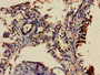 Immunohistochemistry of paraffin-embedded human lung tissue using CAC08088 at dilution of 1:100