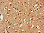 Immunohistochemistry of paraffin-embedded human brain tissue using CAC08089 at dilution of 1:100