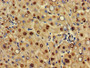 IHC image diluted at 1:500 and staining in paraffin-embedded human liver tissue performed on a Leica BondTM system. After dewaxing and hydration, antigen retrieval was mediated by high pressure in a citrate buffer (pH 6.0). Section was blocked with 10% normal goat serum 30min at RT. Then primary antibody (1% BSA) was incubated at 4°C overnight. The primary is detected by a biotinylated secondary antibody and visualized using an HRP conjugated SP system.