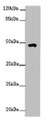 Western blot; All lanes: HS6ST1 antibody at 2 µg/ml + Mouse skeletal muscle tissue; Secondary; Goat polyclonal to rabbit IgG at 1/10000 dilution; Predicted band size: 49, 30 kDa; Observed band size: 49 kDa;