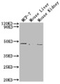 Western Blot; , Positive WB detected in: MCF-7 whole cell lysate, Mouse Liver tissue, Mouse Kidney tissue; , All lanes: NRXN1 antibody at 1:2000; , Secondary; , Goat polyclonal to rabbit IgG at 1/50000 dilution; , Predicted band size: 47 kDa; , Observed band size: 47 kDa;