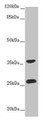 Western blot; All lanes: RAB12 antibody at 2µg/ml + Hela whole cell lysate; Secondary; Goat polyclonal to rabbit IgG at 1/10000 dilution; Predicted band size: 28 kDa; Observed band size: 28, 36 kDa;