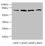 Western blot; All lanes: DARS2 antibody at 16µg/ml; Lane 1: Mouse heart tissue; Lane 2: Mouse liver tissue; Lane 3: Mouse brain tissue; Lane 4: Mouse skeletal muscle tissue; Secondary; Goat polyclonal to rabbit IgG at 1/10000 dilution; Predicted band size: 73 kDa; Observed band size: 73 kDa;