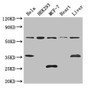 Western Blot; Positive WB detected in: Hela whole cell lysate, HEK293 whole cell lysate, MCF-7 whole cell lysate, Mouse heart tissue, Mouse liver tissue; All lanes: NCOA5 antibody at 3µg/ml; Secondary; Goat polyclonal to rabbit IgG at 1/50000 dilution; Predicted band size: 66 kDa; Observed band size: 66, 35, 25 kDa;