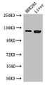 Western Blot; Positive WB detected in: HEK293 whole cell lysate, Mouse liver tissue; All lanes: PDGFRA antibody at 3µg/ml; Secondary; Goat polyclonal to rabbit IgG at 1/50000 dilution; Predicted band size: 123, 25, 83 kDa; Observed band size: 123 kDa;