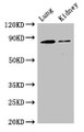 Western Blot; Positive WB detected in: Mouse lung tissue, Mouse kidney tissue; All lanes: CDH5 antibody at 3µg/ml; Secondary; Goat polyclonal to rabbit IgG at 1/50000 dilution; Predicted band size: 88, 75 kDa; Observed band size: 88 kDa;
