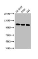 Western Blot; Positive WB detected in: SH-SY5Y whole cell lysate, A549 whole cell lysate, U87 whole cell lysate; All lanes: LRP8 antibody at 3µg/ml; Secondary; Goat polyclonal to rabbit IgG at 1/50000 dilution; Predicted band size: 106, 78, 100, 88 kDa; Observed band size: 106 kDa