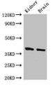 Western Blot; Positive WB detected in: Mouse kidney tissue, Mouse brain tissue; All lanes: FOXE1 antibody at 2.4µg/ml; Secondary; Goat polyclonal to rabbit IgG at 1/50000 dilution; Predicted band size: 39 kDa; Observed band size: 39 kDa;