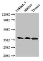 Western Blot; Positive WB detected in: RAW264.7 whole cell lysate, HEK293 whole cell lysate, Rat thymus tissue; All lanes: FHL1 antibody at 3µg/ml; Secondary; Goat polyclonal to rabbit IgG at 1/50000 dilution; Predicted band size: 37, 32, 23, 35, 34 kDa; Observed band size: 37 kDa