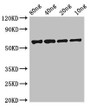 Western Blot; ,Positive WB detected in Recombinant protein; ,All lanes: FSIP2 antibody at 0.8µg/ml; ,Secondary; ,Goat polyclonal to rabbit IgG at 1/50000 dilution; ,predicted band size: 62 kDa; ,observed band size: 62 kDa;