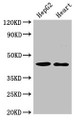 Western Blot; Positive WB detected in: HepG2 whole cell lysate, Rat heart tissue; All lanes: GULP1 antibody at 2µg/ml; Secondary; Goat polyclonal to rabbit IgG at 1/50000 dilution; Predicted band size: 35, 20, 23, 34 kDa; Observed band size: 45 kDa