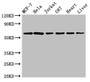 Western Blot; Positive WB detected in: MCF-7 whole cell lysate, Hela whole cell lysate, Jurkat whole cell lysate, U87 whole cell lysate, Rat heart tissue, Rat liver tissue; All lanes: SOCS7 antibody at 3µg/ml; Secondary; Goat polyclonal to rabbit IgG at 1/50000 dilution; Predicted band size: 63, 38 kDa; Observed band size: 63 kDa