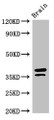 Western Blot; Positive WB detected in: Mouse brain tissue; All lanes: MAPRE2 antibody at 3µg/ml; Secondary; Goat polyclonal to rabbit IgG at 1/50000 dilution; Predicted band size: 38, 30, 36, 33, 31 kDa; Observed band size: 38, 36 kDa;