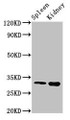 Western Blot; Positive WB detected in: Mouse spleen tissue, Mouse kidney tissue; All lanes: ABT1 antibody at 3µg/ml; Secondary; Goat polyclonal to rabbit IgG at 1/50000 dilution; Predicted band size: 32 kDa; Observed band size: 32 kDa;