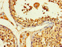 Immunohistochemistry of paraffin-embedded human testis tissue using CAC08207 at dilution of 1:100
