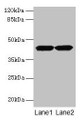Western blot; All lanes: ACTRT2 antibody at 6µg/ml; Lane 1: HepG2 whole cell lysate; Lane 2: A431 whole cell lysate; Secondary; Goat polyclonal to rabbit IgG at 1/10000 dilution; Predicted band size: 42 kDa; Observed band size: 42 kDa