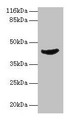 Western blot; All lanes: ADA antibody at 2µg/ml + Jurkat whole cell lysate; Secondary; Goat polyclonal to rabbit IgG at 1/10000 dilution; Predicted band size: 41 kDa; Observed band size: 41 kDa