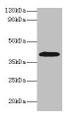 Western blot; All lanes: ADH1B antibody at 2µg/ml + HepG2 whole cell lysate; Secondary; Goat polyclonal to rabbit IgG at 1/15000 dilution; Predicted band size: 40, 36 kDa; Observed band size: 40 kDa