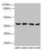 Western blot; All lanes: AKR1C2 antibody at 14µg/ml; Lane 1: HepG2 whole cell lysate; Lane 2: MCF-7 whole cell lysate; Lane 3: Hela whole cell lysate; Lane 4: Rat liver tissue; Secondary; Goat polyclonal to rabbit IgG at 1/10000 dilution; Predicted band size: 37, 16 kDa; Observed band size: 37 kDa