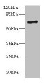 Western blot; All lanes: ALAS2 antibody at 6µg/ml + K562 whole cell lysate; Secondary; Goat polyclonal to rabbit IgG at 1/10000 dilution; Predicted band size: 65, 61, 50, 64 kDa; Observed band size: 65 kDa