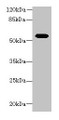 Western blot; All lanes: Aldh1a1 antibody at 8µg/ml + Mouse eye tissue; Secondary; Goat polyclonal to rabbit IgG at 1/10000 dilution; Predicted band size: 55 kDa; Observed band size: 55 kDa