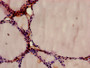 Immunohistochemistry of paraffin-embedded human thyroid tissue using CAC08232 at dilution of 1:100